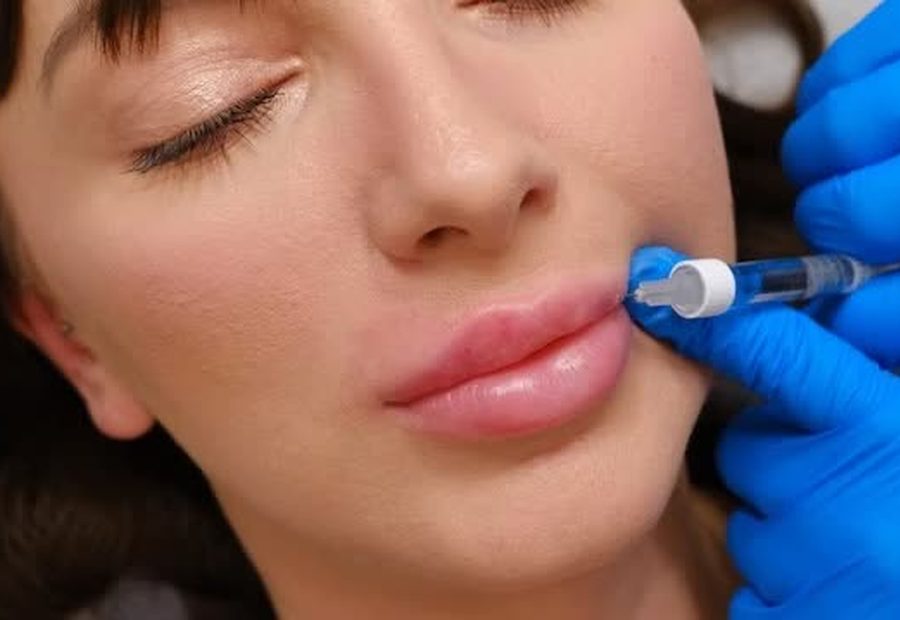 A lip filler treatment being carried out at the clinic.
